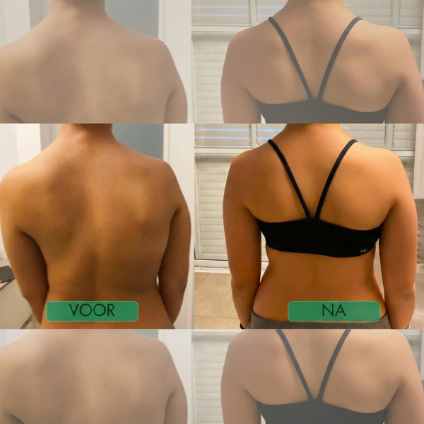 Posture Corrector