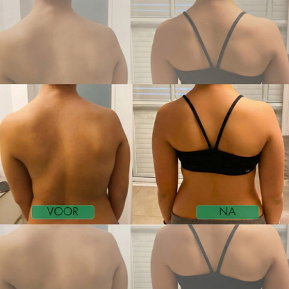 Posture Corrector