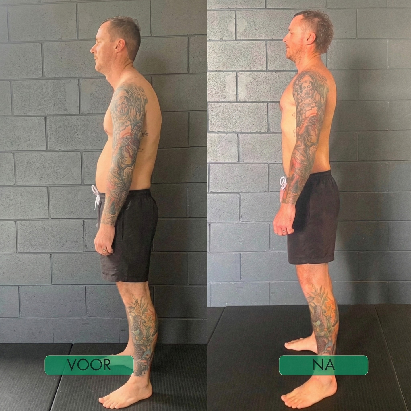 Ergonomische Houdingcorrector